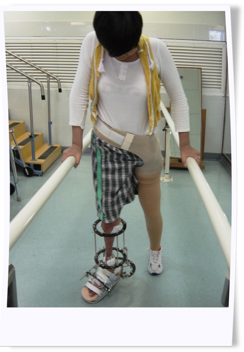 她在醫院物理治療部練習步行