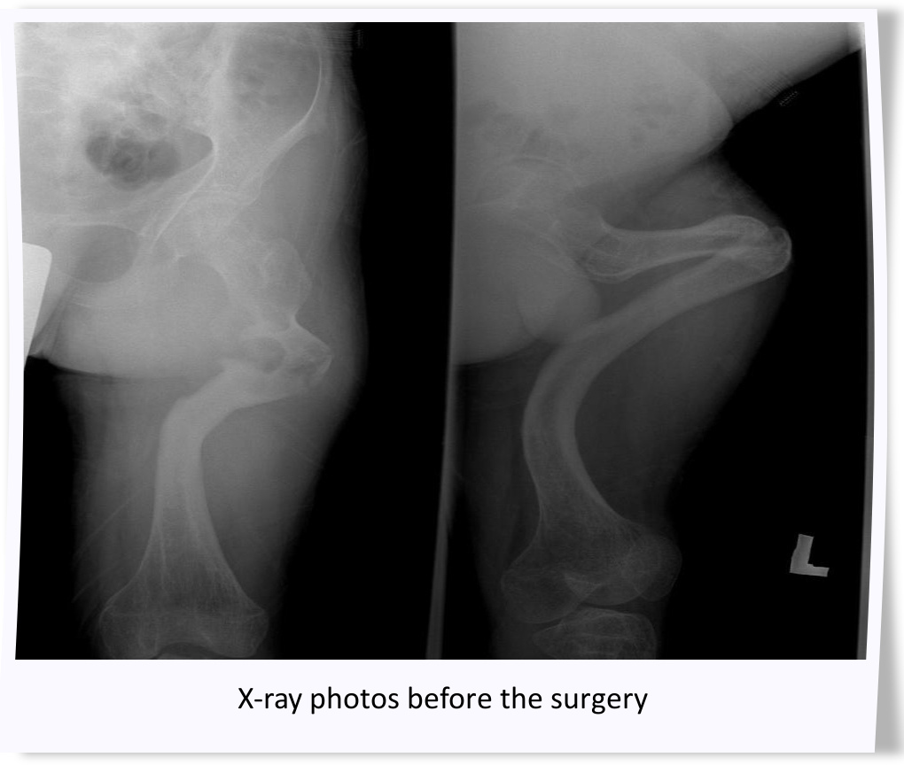X-ray before the surgery